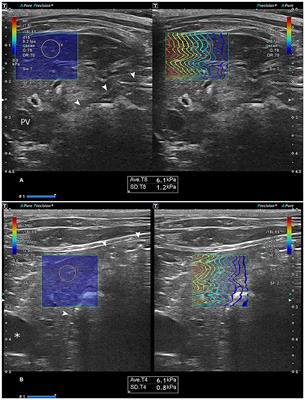 Feasibility and Reliability of Two-Dimensional Shear-Wave Elastography of the Liver of Clinically Healthy Cats